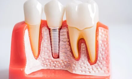 Root Canal Healing Time: What to Expect